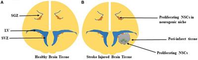 Stroke Repair via Biomimicry of the Subventricular Zone